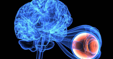 تومور کاذب مغزی چیست و چه علائمی دارد 